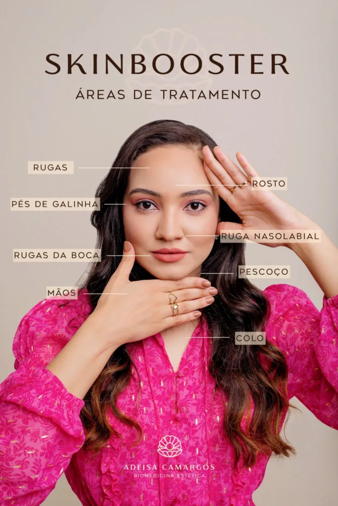 Áreas de Tratamento para Skinbooster - onde o skinbooster pode ser aplicado - skinbooster betim