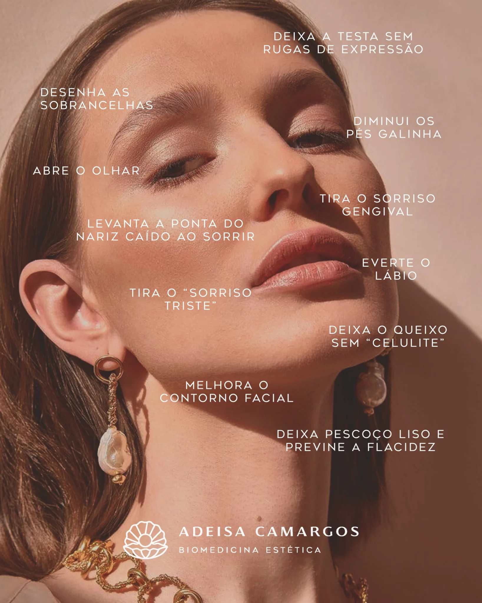 Adeisa Camargos - áreas de aplicação toxina botulínica estética - tratamento para rugas