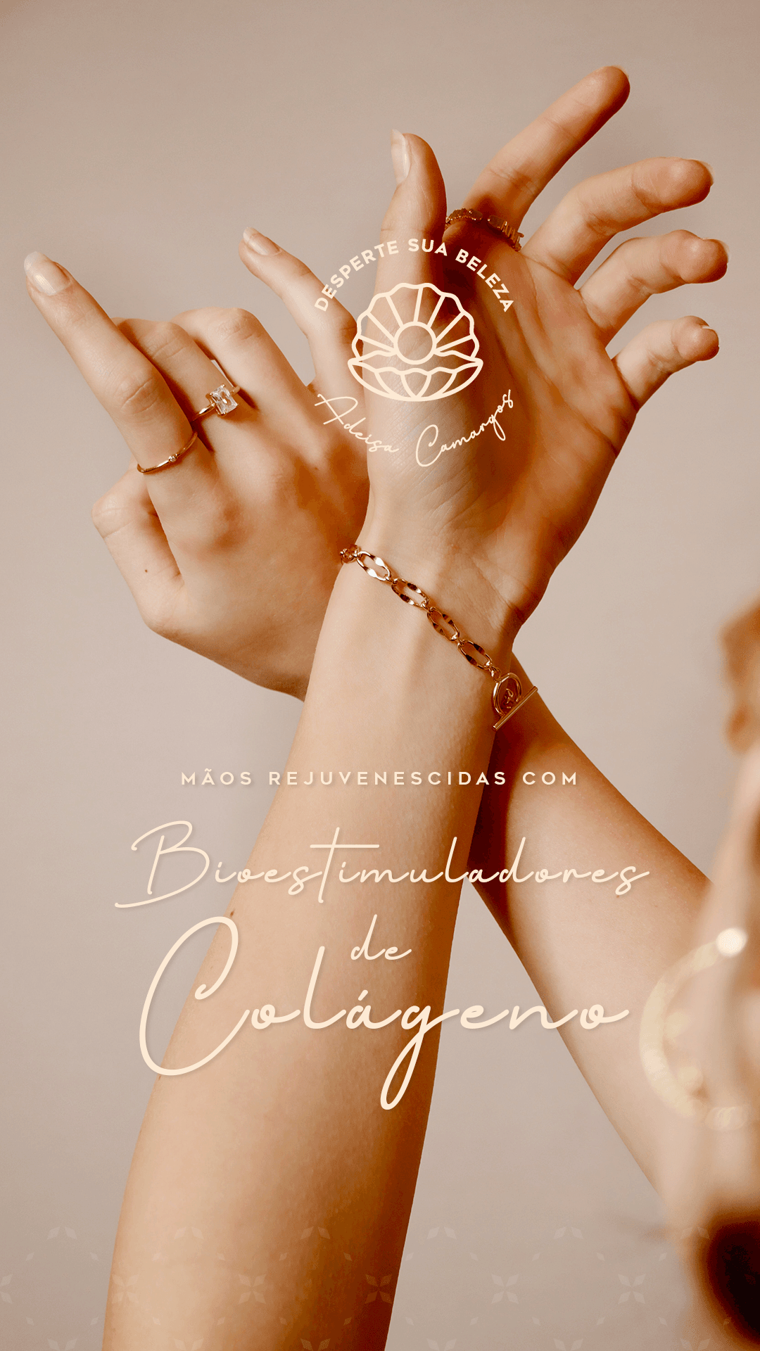Mãos rejuvenescidas com bioestimuladores de colágeno