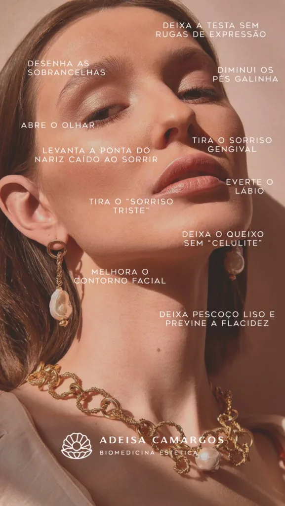Adeisa Camargos - áreas de aplicação toxina botulínica estética