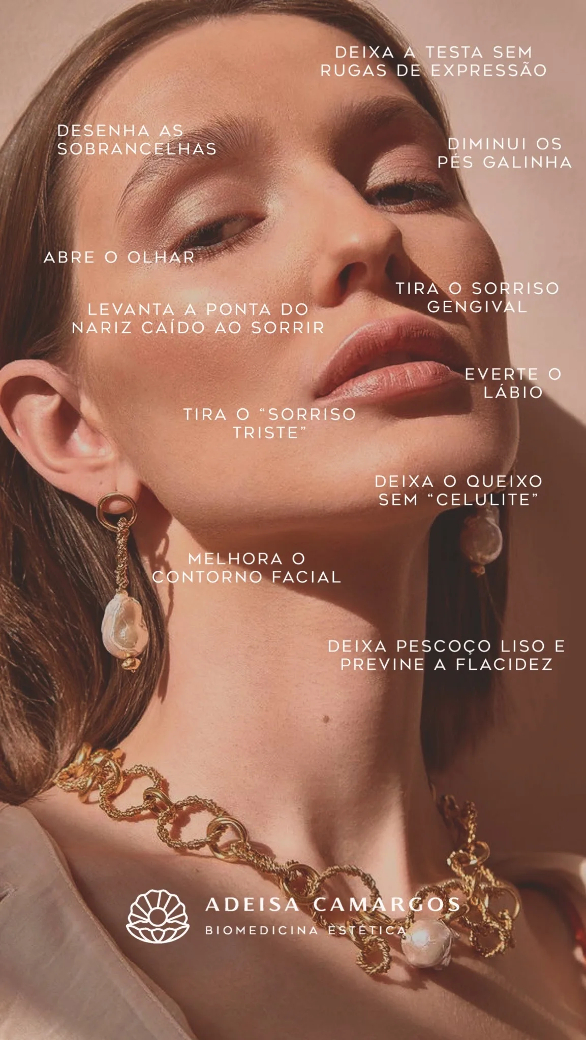 Adeisa Camargos - áreas de aplicação toxina botulínica estética