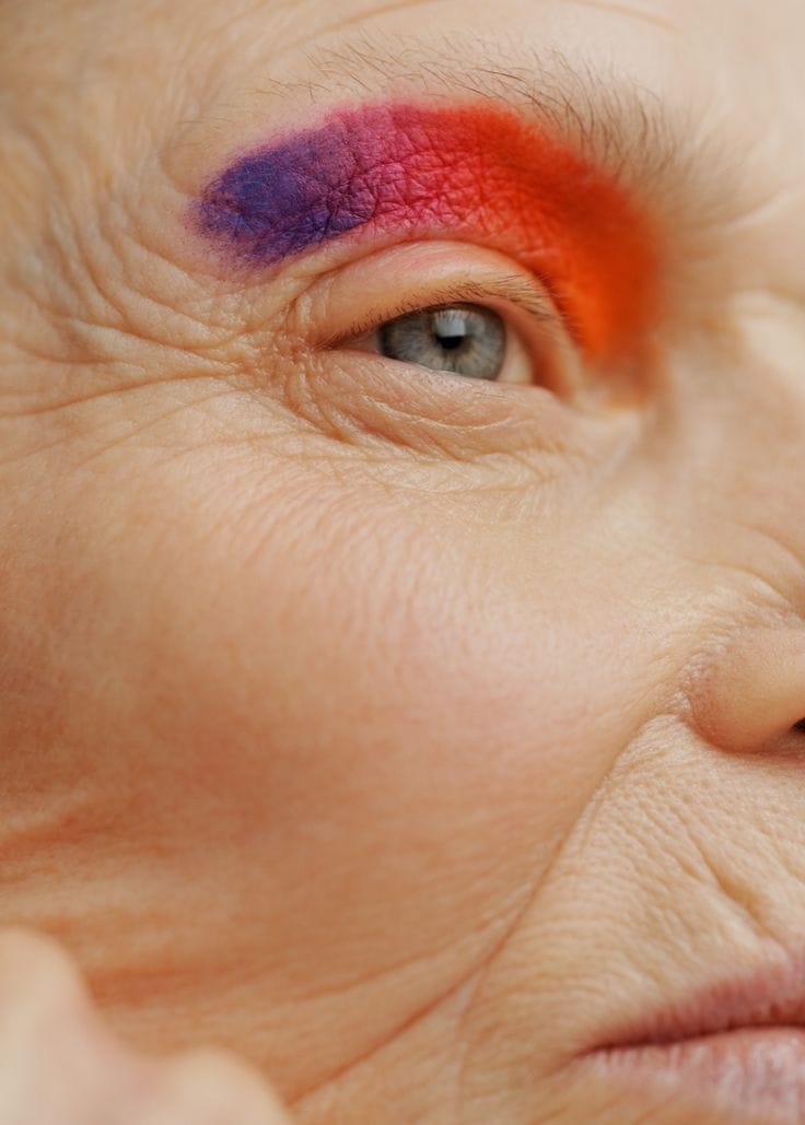 Como Tratar os Pés de Galinha: Dicas e Soluções para Reverter os Sinais do Tempo