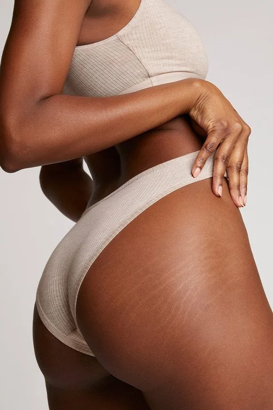 Sculptra ou Radiesse: O Duelo de Titãs que Sua Pele Vai Amar sculptra ou radiesse,sculptra e radiesse