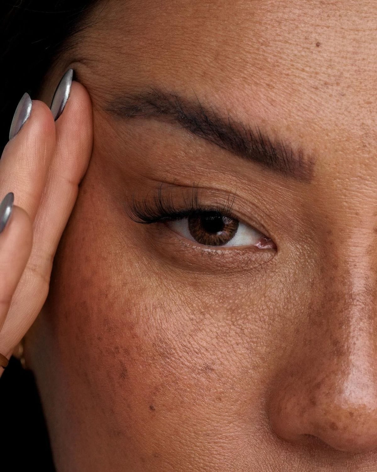 Toxina Botulínica: Suavize Rugas e Rejuvenesça toxina botulínica,botox facial Betim,aplicação botox biomédica