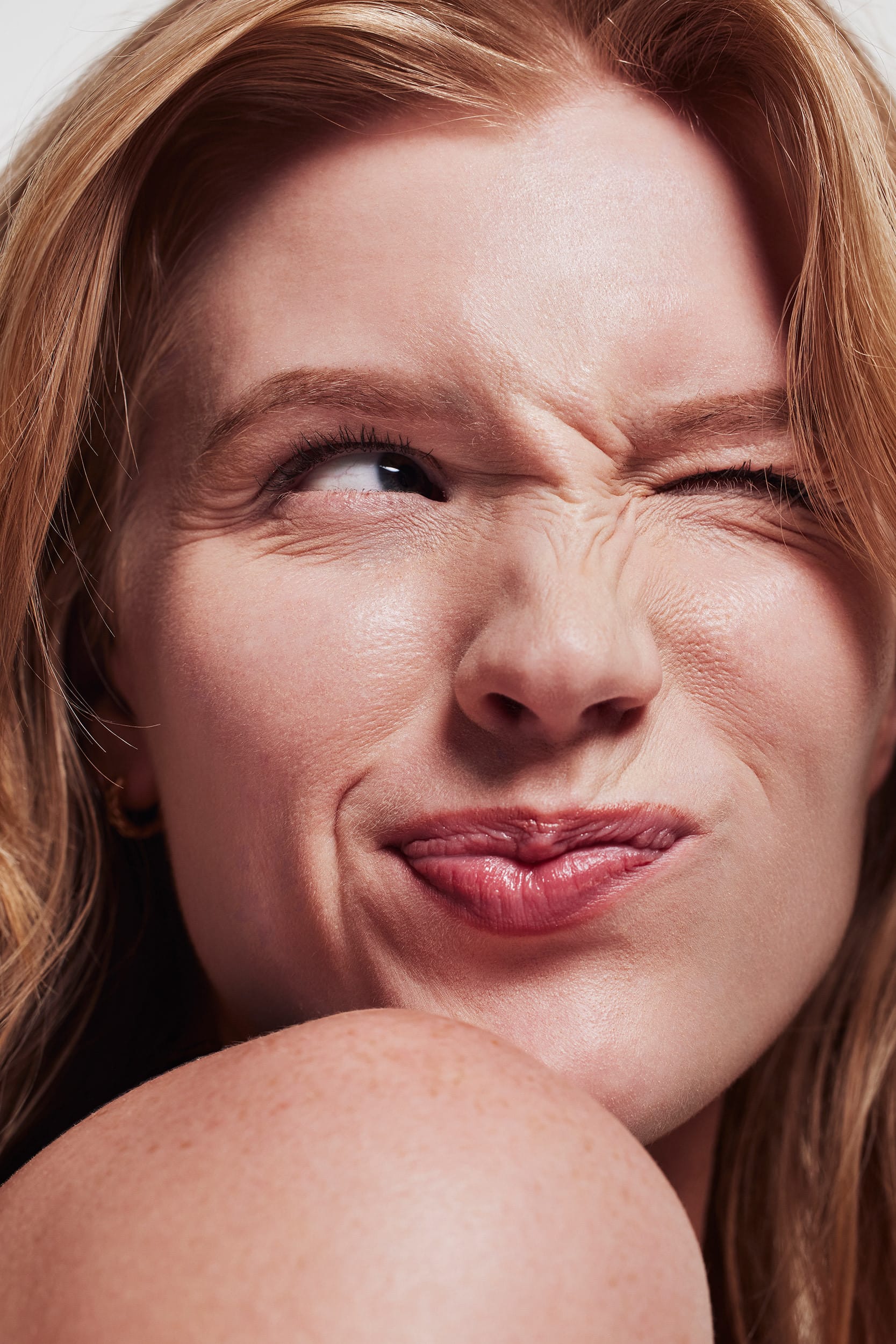 Como Tratar os Pés de Galinha: Dicas e Soluções para Reverter os Sinais do Tempo Pés de Galinha