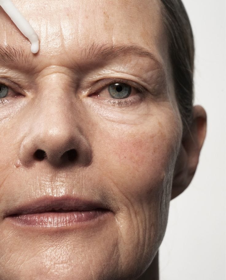 Rugas, Flacidez e Cabelos Frágeis: Os Desafios Estéticos da Menopausa