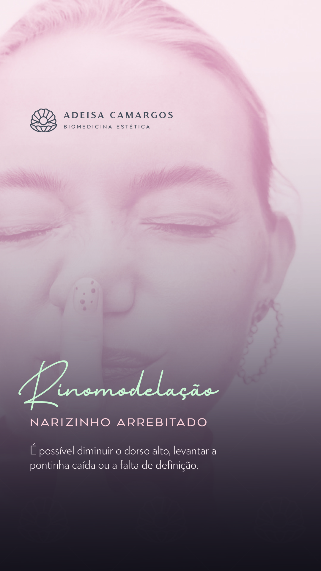 Rinomodelação - afinar o nariz