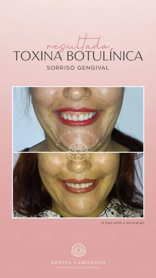 Adeísa Camargos - Clínica de Estética Avançada e Harmonização Facial em Betim e Região Adeisa Camargos,clínica de estética