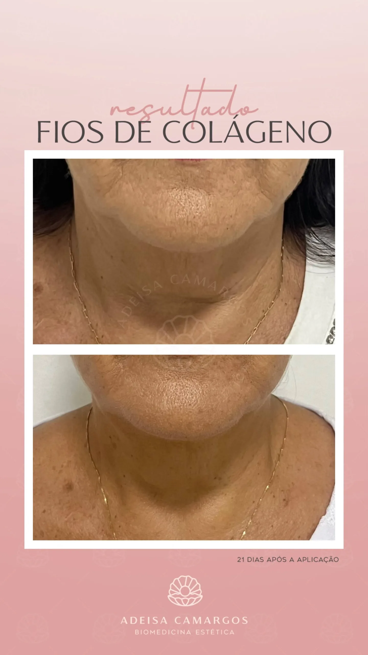 Adeísa Camargos - Clínica de Estética Avançada e Harmonização Facial em Betim e Região Adeisa Camargos,clínica de estética