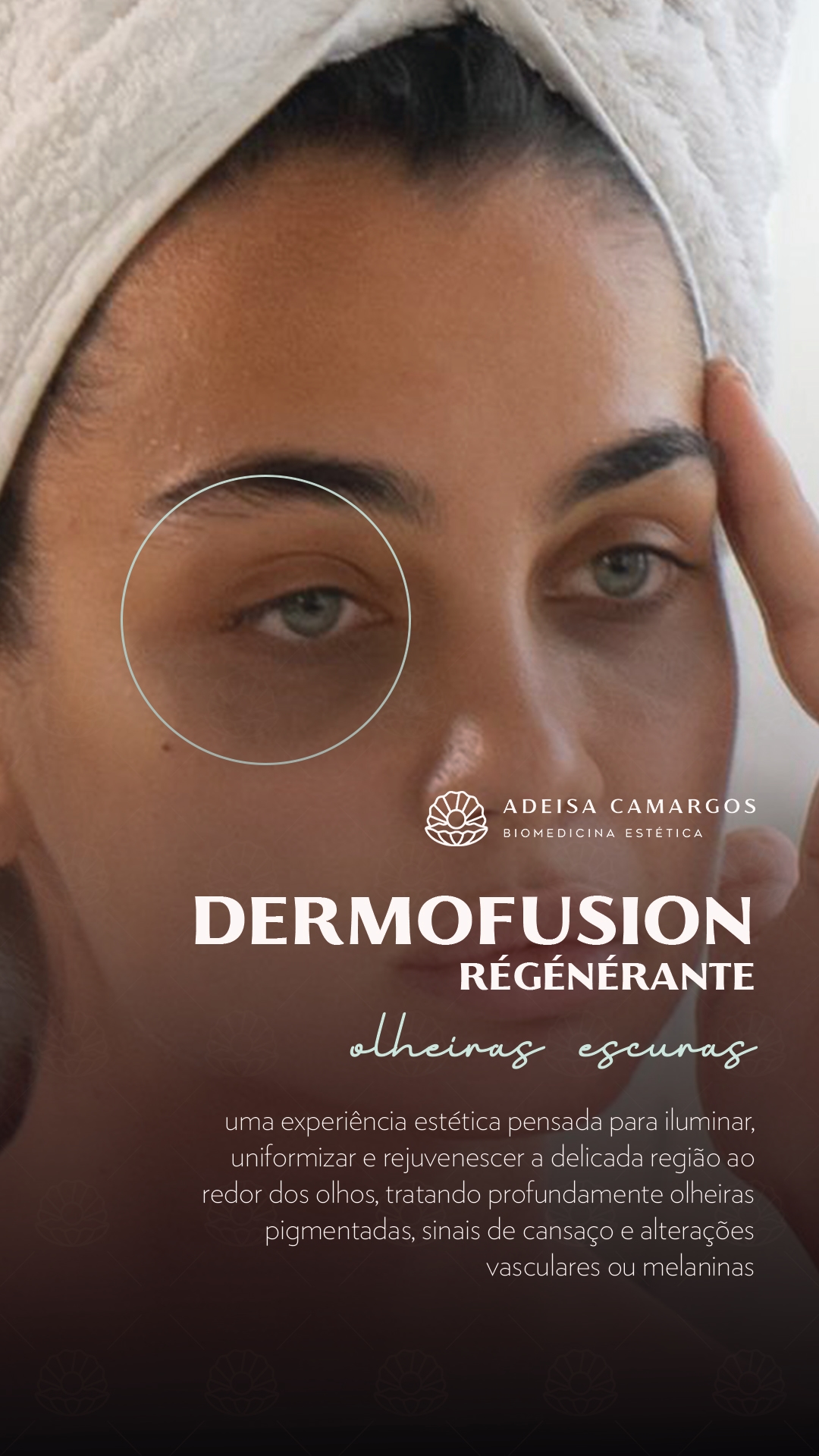 Resultados Antes e Depois da Dra. Adeisa Camargos 54 Adeisa Camargos Resultados Antes e Depois da Dra. Adeisa Camargos Resultados Antes e Depois,Antes e depois