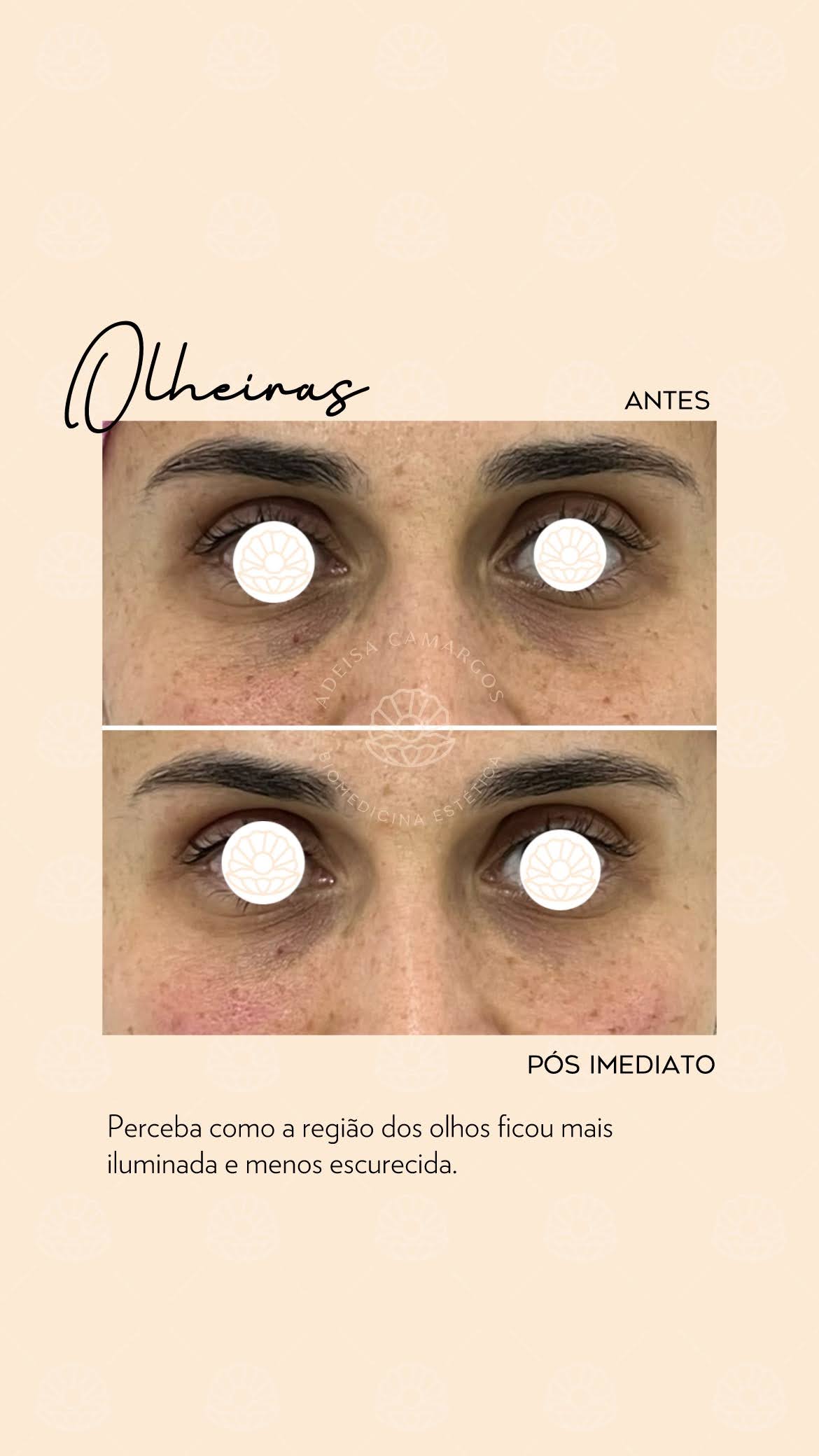 Adeísa Camargos - Clínica de Estética Avançada e Harmonização Facial em Betim e Região Adeisa Camargos,clínica de estética