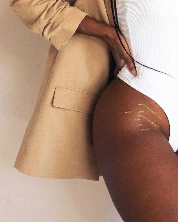 Pele Uniforme: Conheça o Tratamento Regenerativo para Estrias exossomos