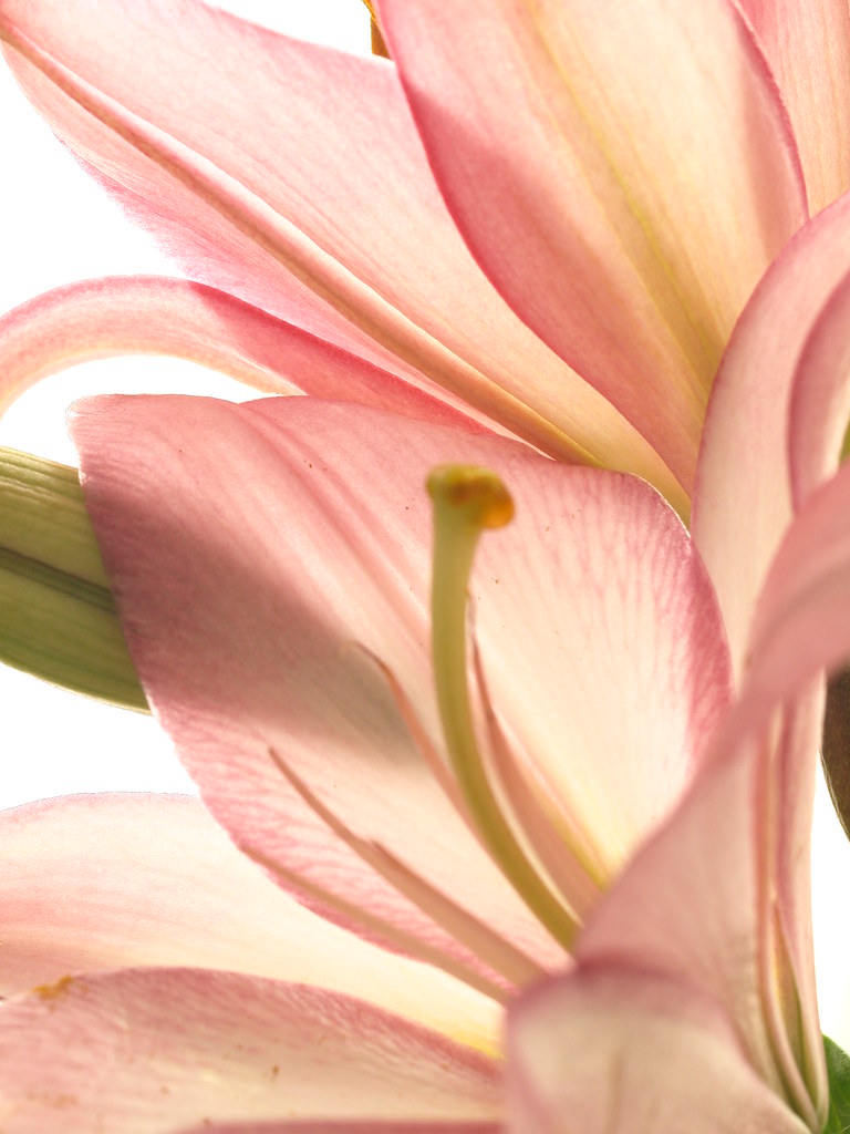 Resultados Antes e Depois da Dra. Adeisa Camargos 63 Adeisa Camargos Resultados Antes e Depois da Dra. Adeisa Camargos Resultados Antes e Depois,Antes e depois